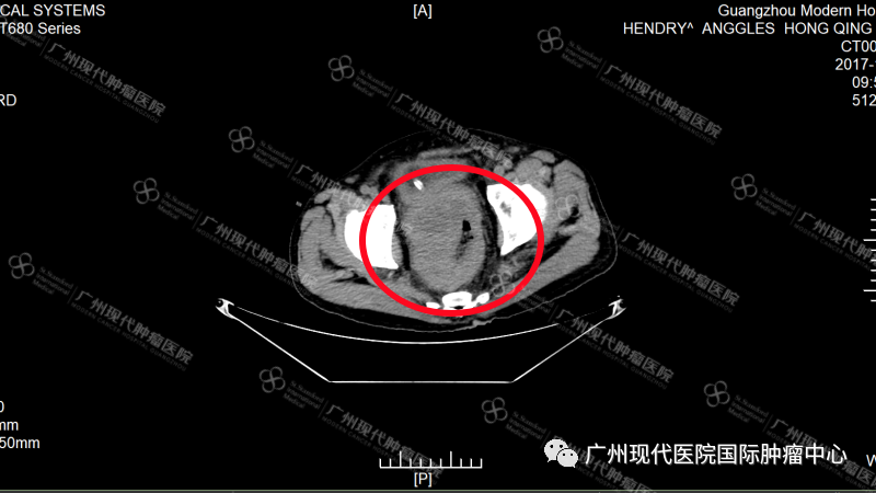 1693275033438329.png 2.png